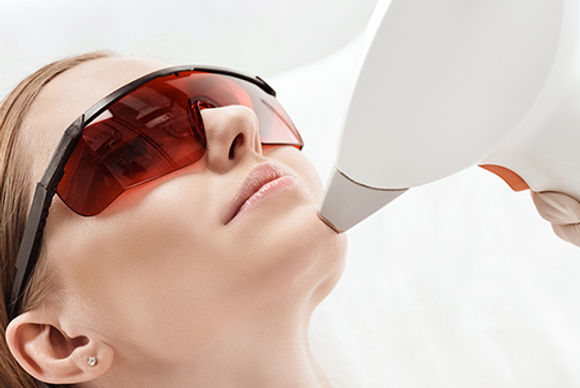 CHIN HAIR REMOVAL with DIODE LASER