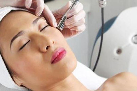 MICRODERMABRASIÓN