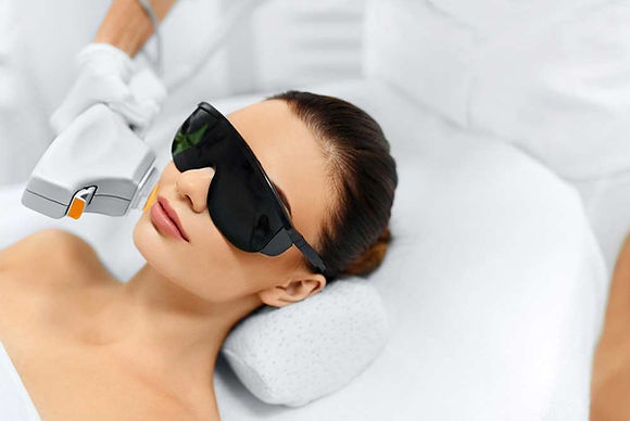 BEARD HAIR REMOVAL WITH DIODE LASER