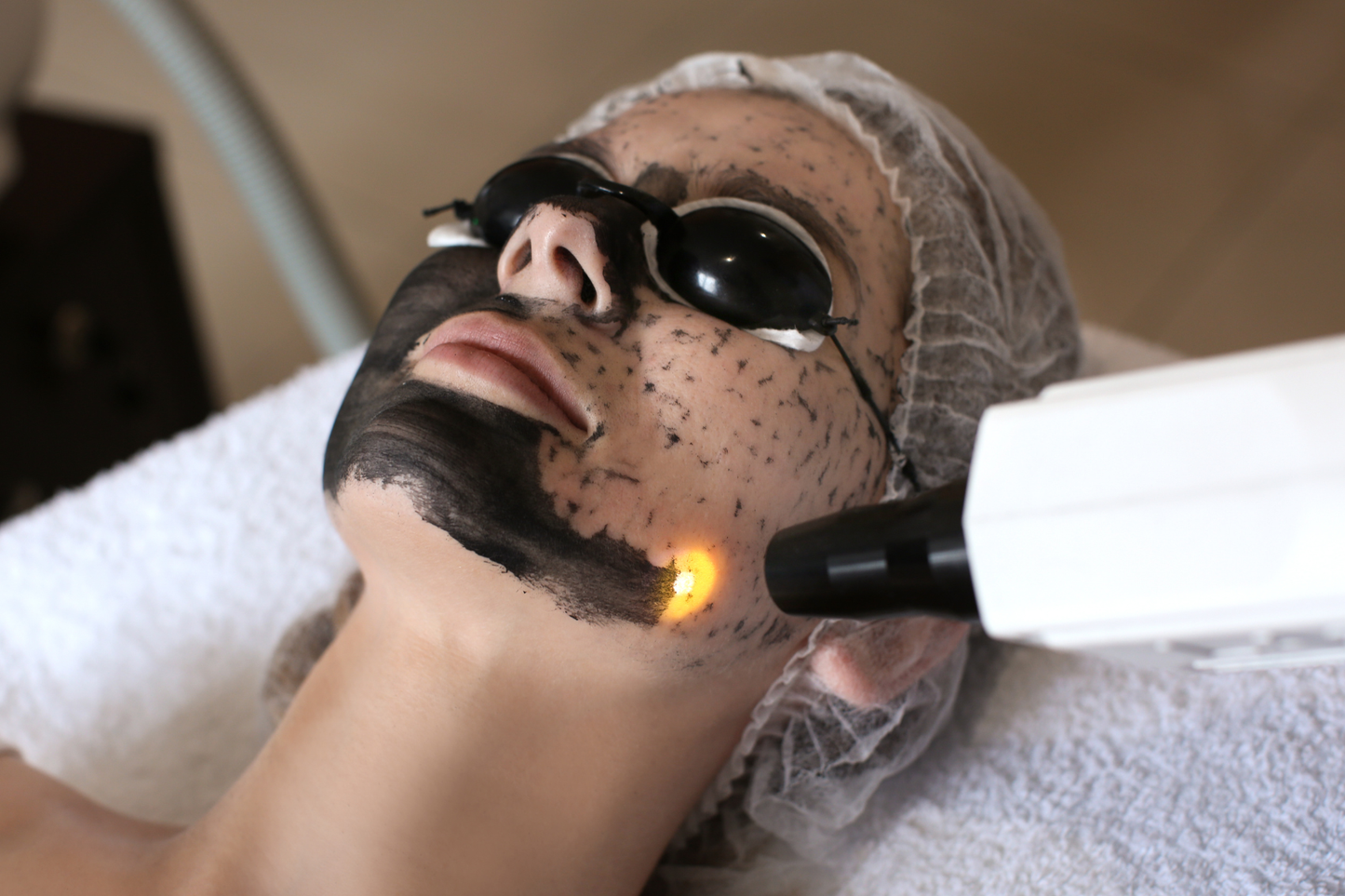 HOLLYWOOD LASER PEEL