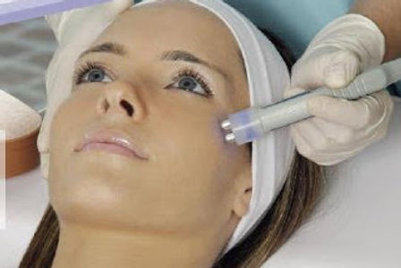 Radiofrecuencia Facial