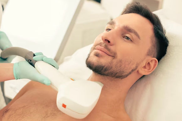 6 Diode Laser Sessions on Beard