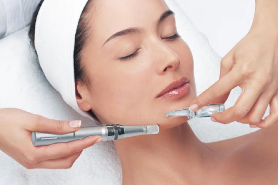 LIMPIEZA FACIAL PROFUNDA+ MICROAGUJAS FACIALES