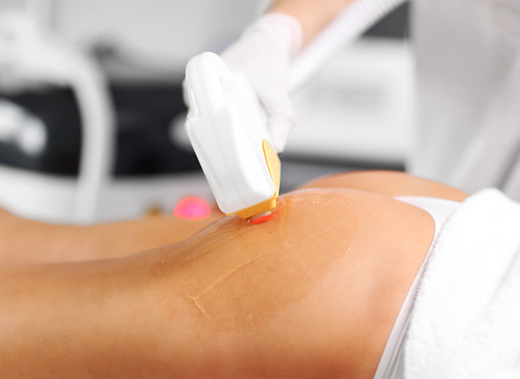 Diode Laser Hair Removal on Buttocks